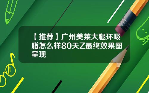 【推荐】广州美莱大腿环吸脂怎么样80天Z最终效果图呈现