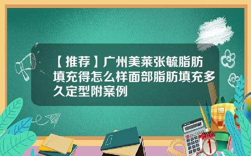 【推荐】广州美莱张毓脂肪填充得怎么样面部脂肪填充多久定型附案例