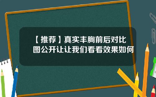 【推荐】真实丰胸前后对比图公开让让我们看看效果如何