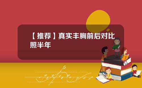 【推荐】真实丰胸前后对比照半年