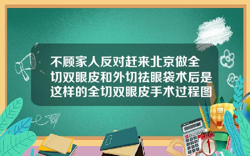 不顾家人反对赶来北京做全切双眼皮和外切祛眼袋术后是这样的全切双眼皮手术过程图