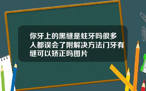 你牙上的黑缝是蛀牙吗很多人都误会了附解决方法门牙有缝可以矫正吗图片