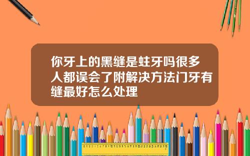 你牙上的黑缝是蛀牙吗很多人都误会了附解决方法门牙有缝最好怎么处理