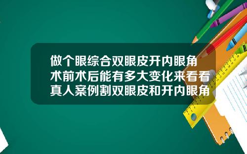 做个眼综合双眼皮开内眼角术前术后能有多大变化来看看真人案例割双眼皮和开内眼角20天的图片大全