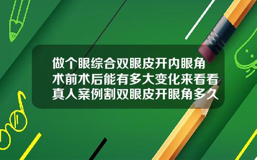 做个眼综合双眼皮开内眼角术前术后能有多大变化来看看真人案例割双眼皮开眼角多久能恢复正常