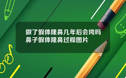 做了假体隆鼻几年后会垮吗鼻子假体隆鼻过程图片