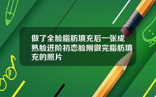 做了全脸脂肪填充后一张成熟脸进阶初恋脸刚做完脂肪填充的照片