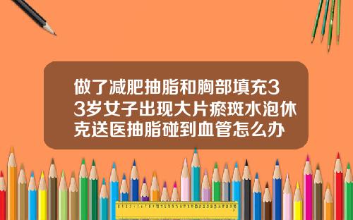 做了减肥抽脂和胸部填充33岁女子出现大片瘀斑水泡休克送医抽脂碰到血管怎么办