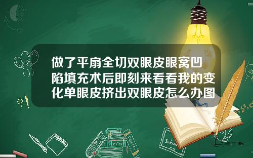 做了平扇全切双眼皮眼窝凹陷填充术后即刻来看看我的变化单眼皮挤出双眼皮怎么办图片