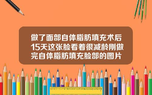 做了面部自体脂肪填充术后15天这张脸看着很减龄刚做完自体脂肪填充脸部的图片