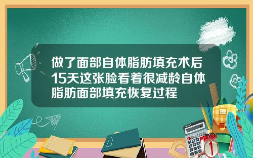 做了面部自体脂肪填充术后15天这张脸看着很减龄自体脂肪面部填充恢复过程