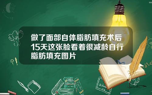 做了面部自体脂肪填充术后15天这张脸看着很减龄自行脂肪填充图片