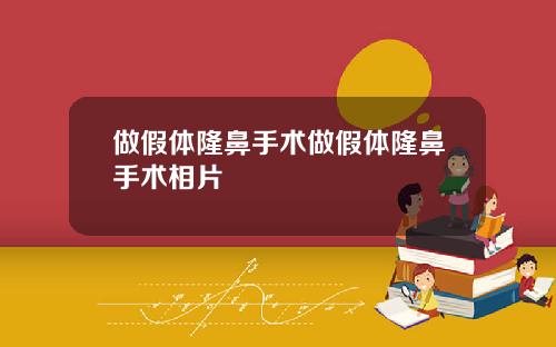 做假体隆鼻手术做假体隆鼻手术相片