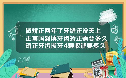 做矫正两年了牙缝还没关上正常吗淄博牙齿矫正需要多久矫正牙齿拔牙4颗收缝要多久