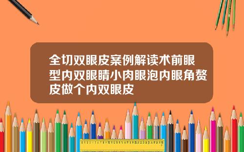 全切双眼皮案例解读术前眼型内双眼睛小肉眼泡内眼角赘皮做个内双眼皮