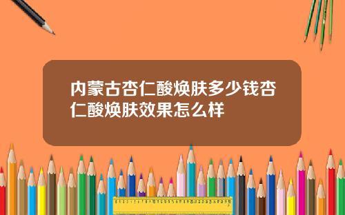 内蒙古杏仁酸焕肤多少钱杏仁酸焕肤效果怎么样