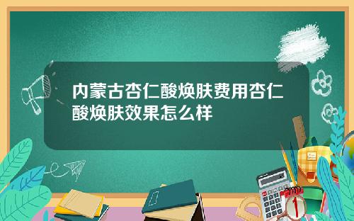 内蒙古杏仁酸焕肤费用杏仁酸焕肤效果怎么样