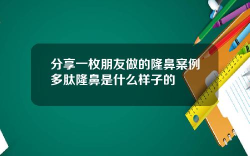 分享一枚朋友做的隆鼻案例多肽隆鼻是什么样子的