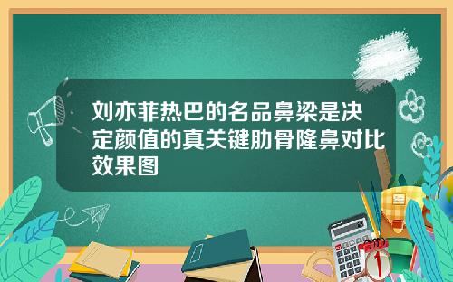 刘亦菲热巴的名品鼻梁是决定颜值的真关键肋骨隆鼻对比效果图