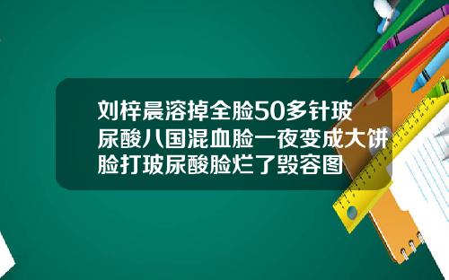 刘梓晨溶掉全脸50多针玻尿酸八国混血脸一夜变成大饼脸打玻尿酸脸烂了毁容图