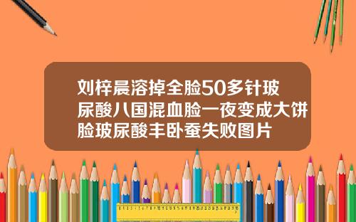 刘梓晨溶掉全脸50多针玻尿酸八国混血脸一夜变成大饼脸玻尿酸丰卧蚕失败图片
