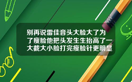 别再说雷佳音头大脸大了为了瘦脸他把头发生生抬高了一大截大小脸打完瘦脸针更明显了