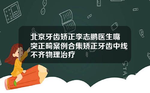 北京牙齿矫正李志鹏医生嘴突正畸案例合集矫正牙齿中线不齐物理治疗