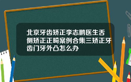 北京牙齿矫正李志鹏医生舌侧矫正正畸案例合集三矫正牙齿门牙外凸怎么办