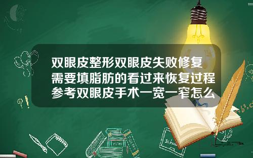 双眼皮整形双眼皮失败修复需要填脂肪的看过来恢复过程参考双眼皮手术一宽一窄怎么办