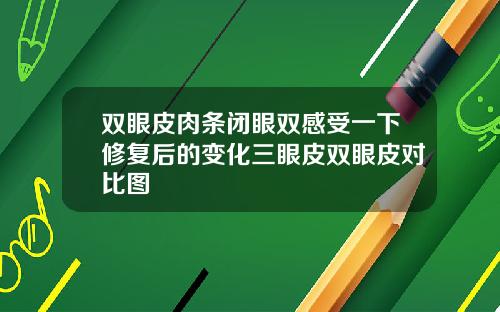 双眼皮肉条闭眼双感受一下修复后的变化三眼皮双眼皮对比图