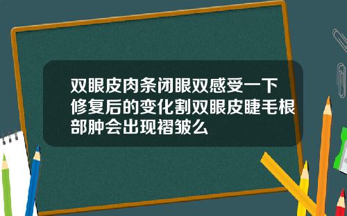 双眼皮肉条闭眼双感受一下修复后的变化割双眼皮睫毛根部肿会出现褶皱么