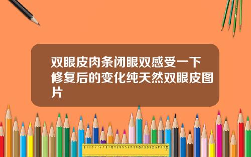 双眼皮肉条闭眼双感受一下修复后的变化纯天然双眼皮图片