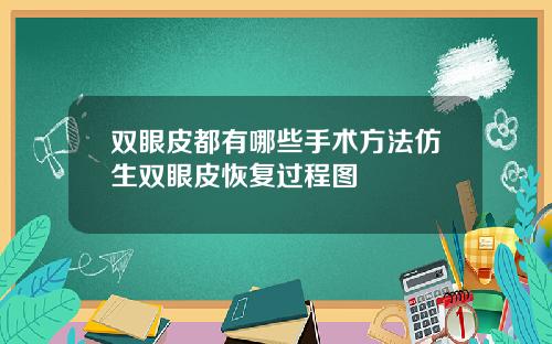 双眼皮都有哪些手术方法仿生双眼皮恢复过程图