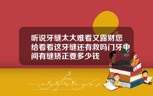 听说牙缝太大难看又露财您给看看这牙缝还有救吗门牙中间有缝矫正要多少钱