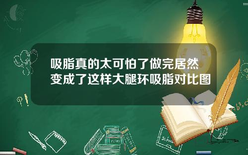 吸脂真的太可怕了做完居然变成了这样大腿环吸脂对比图