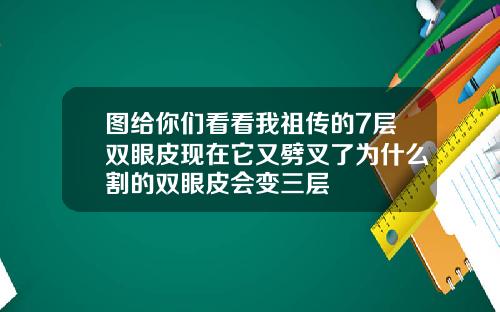 图给你们看看我祖传的7层双眼皮现在它又劈叉了为什么割的双眼皮会变三层