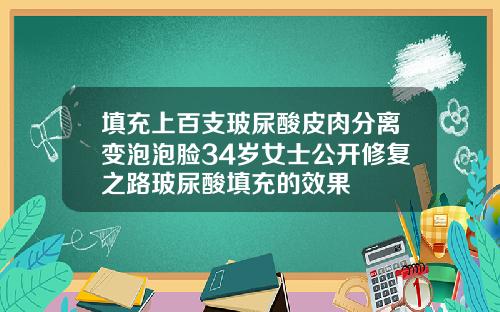 填充上百支玻尿酸皮肉分离变泡泡脸34岁女士公开修复之路玻尿酸填充的效果