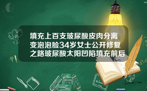 填充上百支玻尿酸皮肉分离变泡泡脸34岁女士公开修复之路玻尿酸太阳凹陷填充前后图片