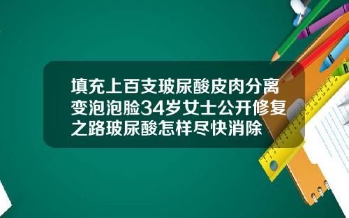 填充上百支玻尿酸皮肉分离变泡泡脸34岁女士公开修复之路玻尿酸怎样尽快消除
