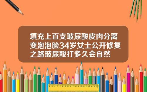 填充上百支玻尿酸皮肉分离变泡泡脸34岁女士公开修复之路玻尿酸打多久会自然
