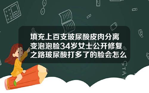 填充上百支玻尿酸皮肉分离变泡泡脸34岁女士公开修复之路玻尿酸打多了的脸会怎么样