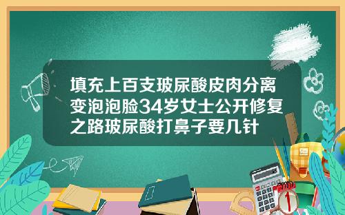 填充上百支玻尿酸皮肉分离变泡泡脸34岁女士公开修复之路玻尿酸打鼻子要几针