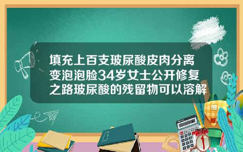 填充上百支玻尿酸皮肉分离变泡泡脸34岁女士公开修复之路玻尿酸的残留物可以溶解掉吗