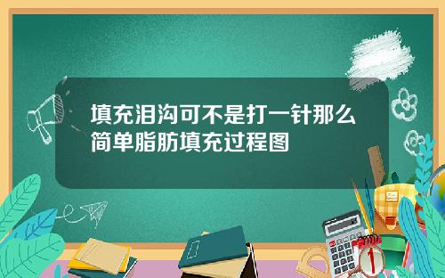 填充泪沟可不是打一针那么简单脂肪填充过程图