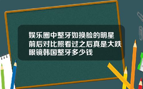 娱乐圈中整牙如换脸的明星前后对比照看过之后真是大跌眼镜韩国整牙多少钱