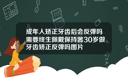 成年人矫正牙齿后会反弹吗需要终生佩戴保持器30岁做牙齿矫正反弹吗图片