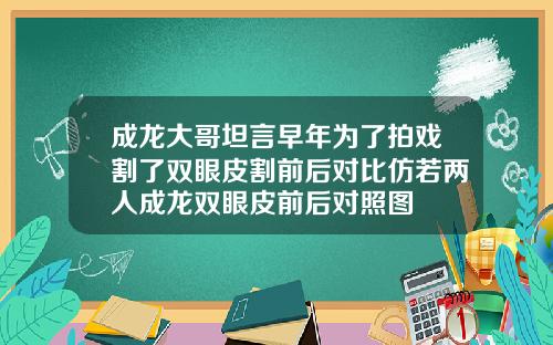 成龙大哥坦言早年为了拍戏割了双眼皮割前后对比仿若两人成龙双眼皮前后对照图