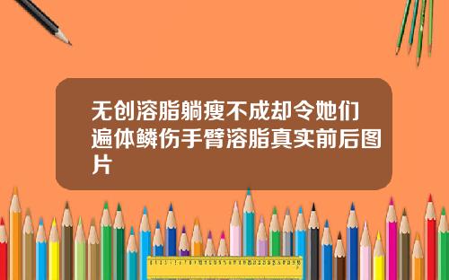 无创溶脂躺瘦不成却令她们遍体鳞伤手臂溶脂真实前后图片