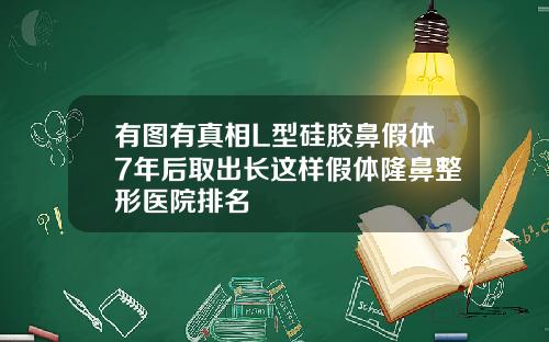 有图有真相L型硅胶鼻假体7年后取出长这样假体隆鼻整形医院排名