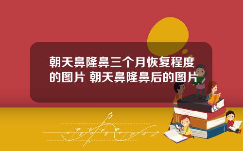 朝天鼻隆鼻三个月恢复程度的图片 朝天鼻隆鼻后的图片